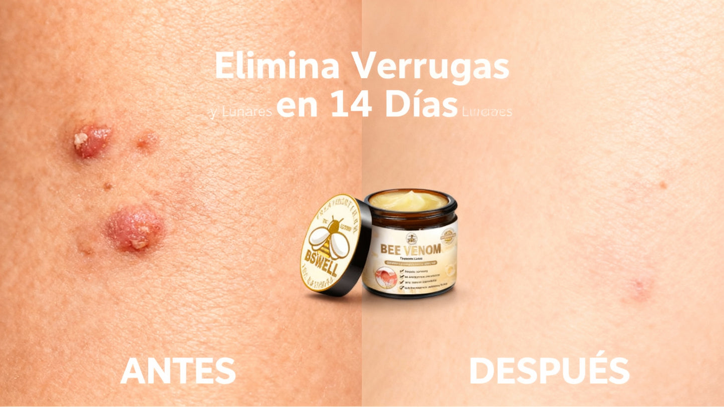 Bee Venom BSWELL "ADIÓS A LAS VERRUGAS Y FLACIDEZ: El Secreto Natural que los Dermatólogos No Quieren que Conozcas